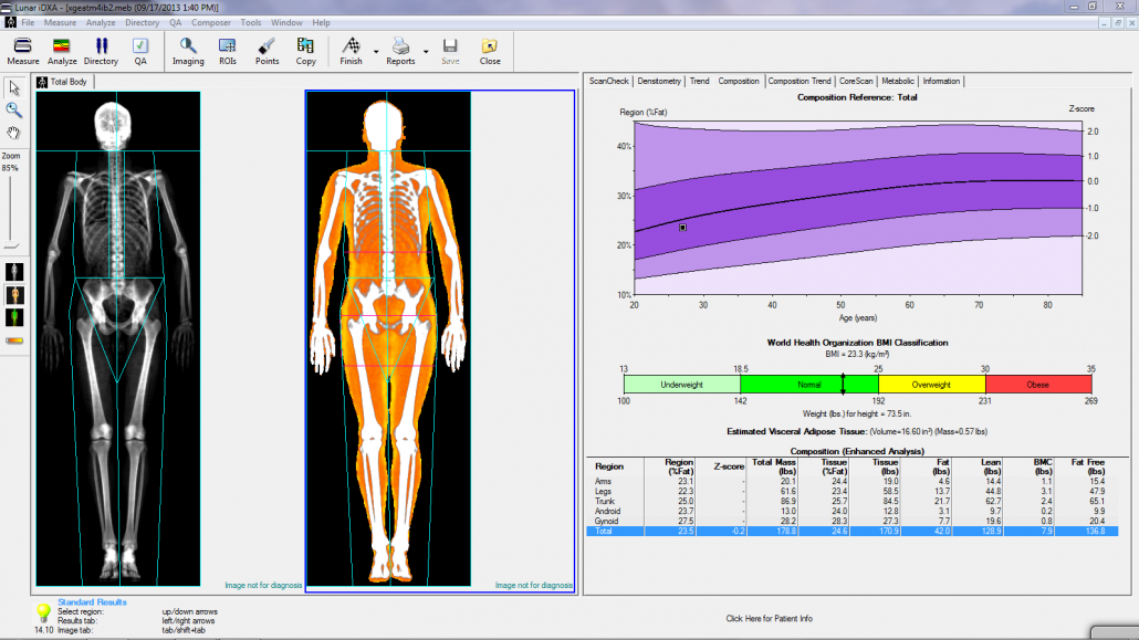 Όνομα: dexa-1030x579.png Εμφανίσεις: 1301 Μέγεθος: 361,3 KB